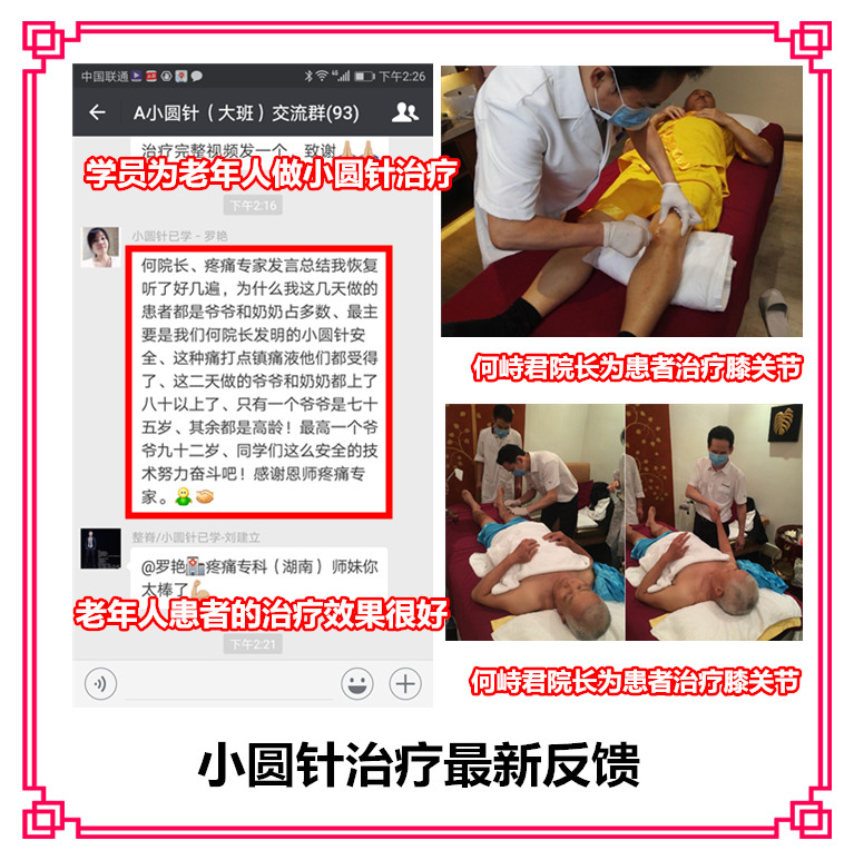 小圓針班（9月25日成都）何峙君小圓針技術臨床帶教班